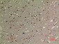 p73 (Acetyl Lys321) Polyclonal Antibody